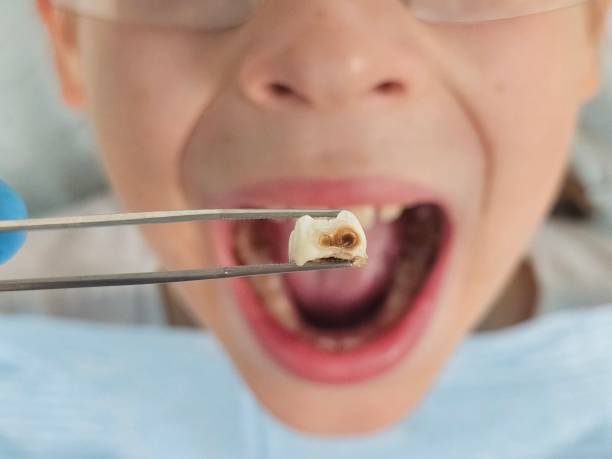 Best Emergency Dental Surgery in Woodville, TX