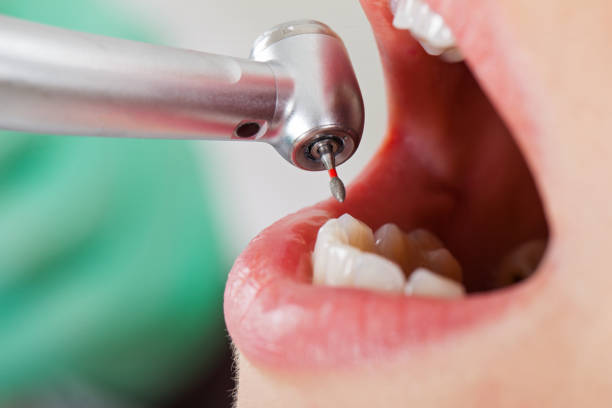 Best Emergency Treatment for Toothache in Woodville, TX